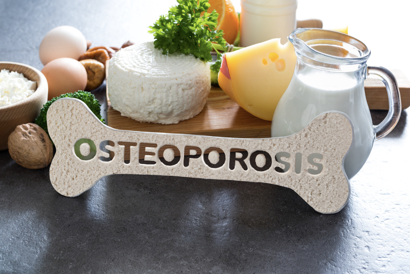 Prévenir l’ostéoporose : alimentation et exercices à privilégier